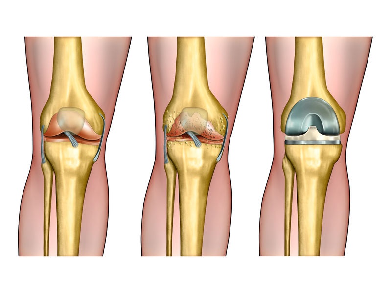Knee Pain Masterclass
